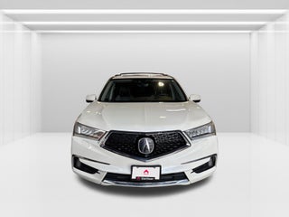 2017 Acura MDX